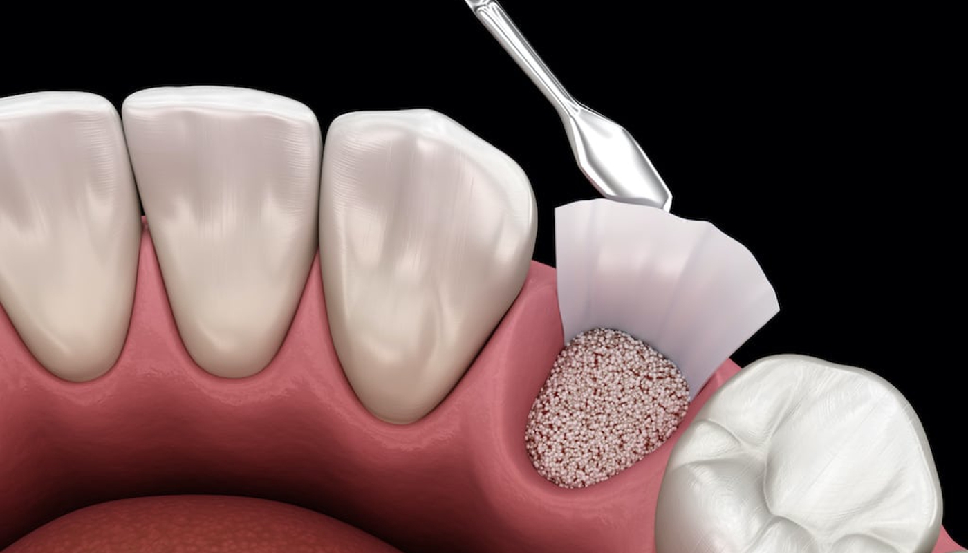 Odontoiatria conservativa